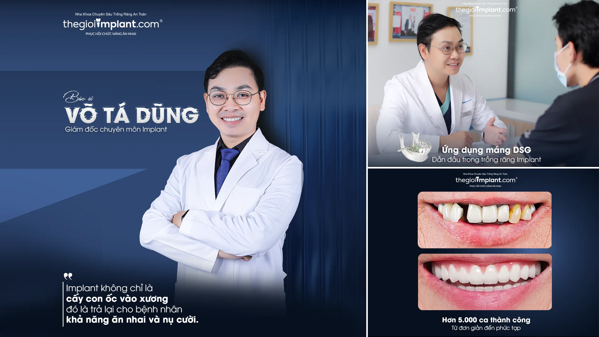 implant all on 4 tphcm - hình 5