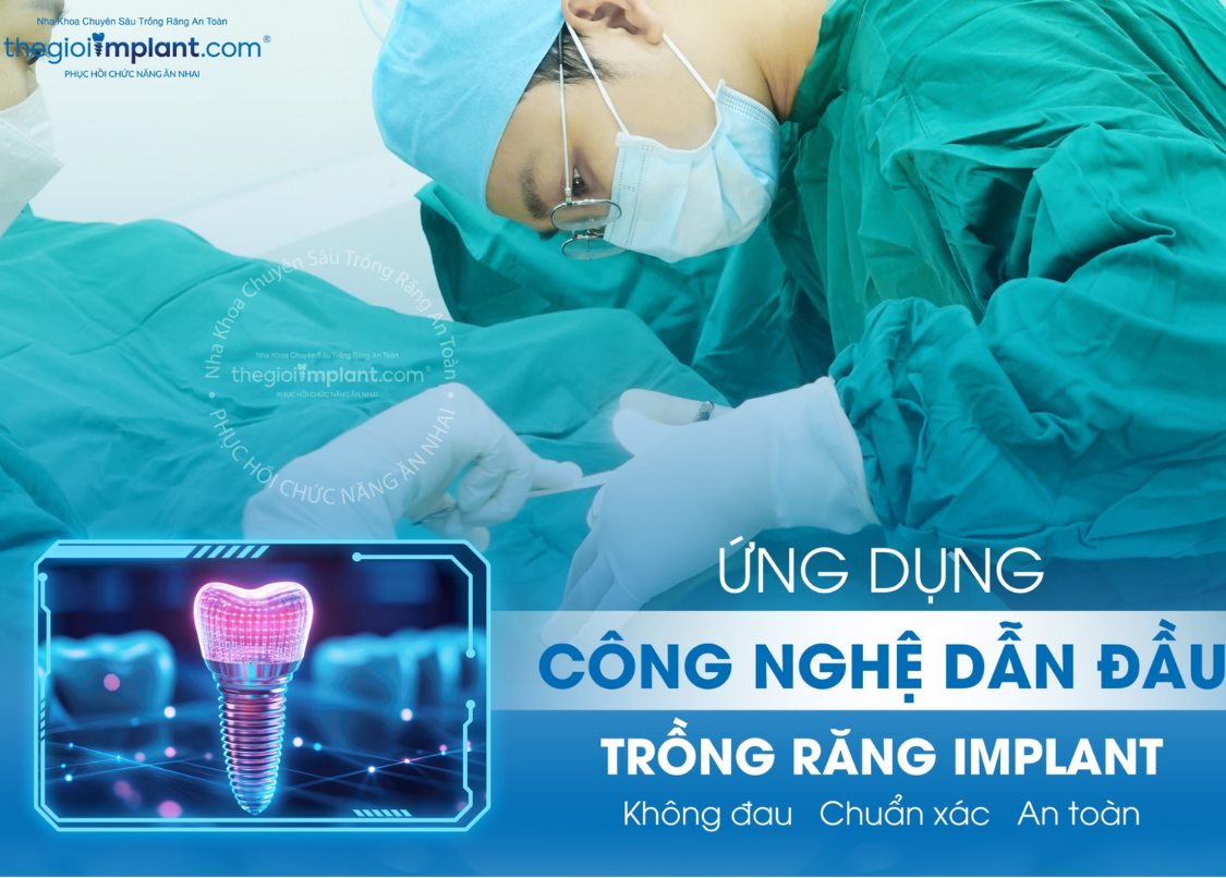 Trồng răng Implant vs cầu răng: chọn nào 2026