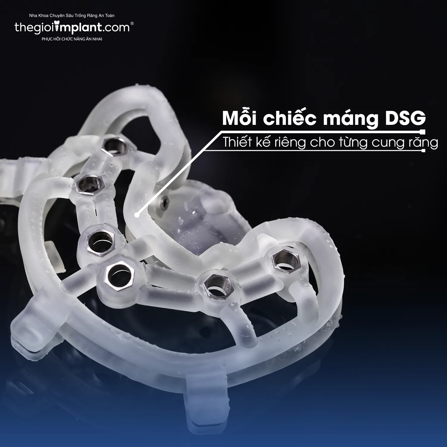 implant mất nhiều răng - hình 6