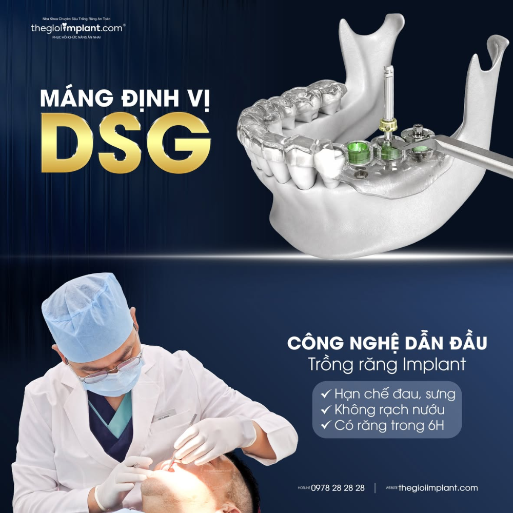 implant người lớn tuổi