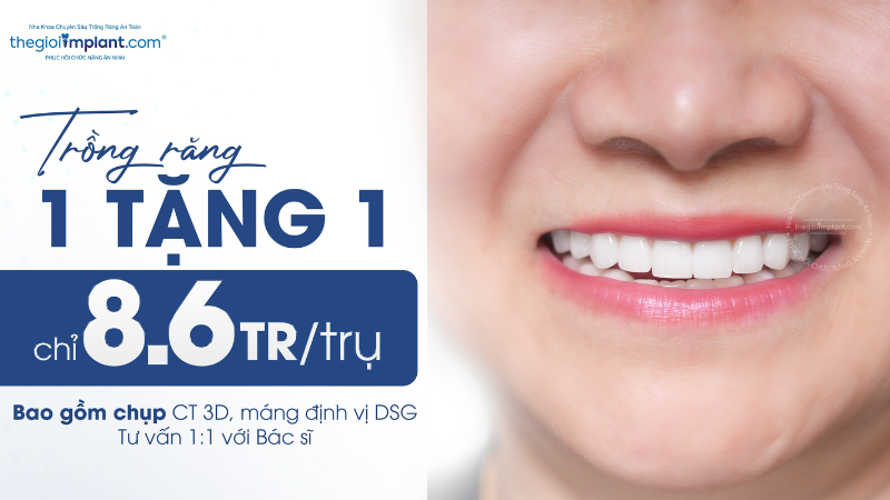 Trồng Implant Dio TGI 1 tặng 1 chỉ 8.6 triệu 2026