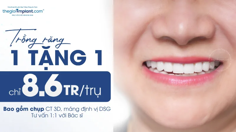 Trồng Implant Dio TGI 1 tặng 1 chỉ 8.6 triệu 2026