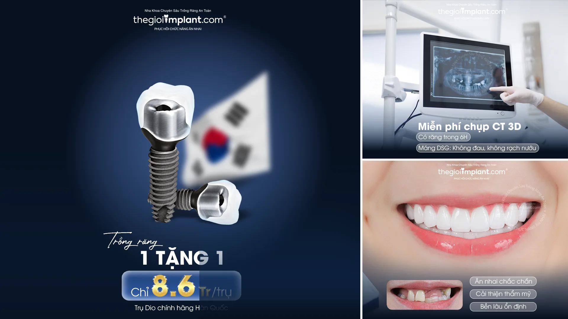 trồng implant dio - hình 3
