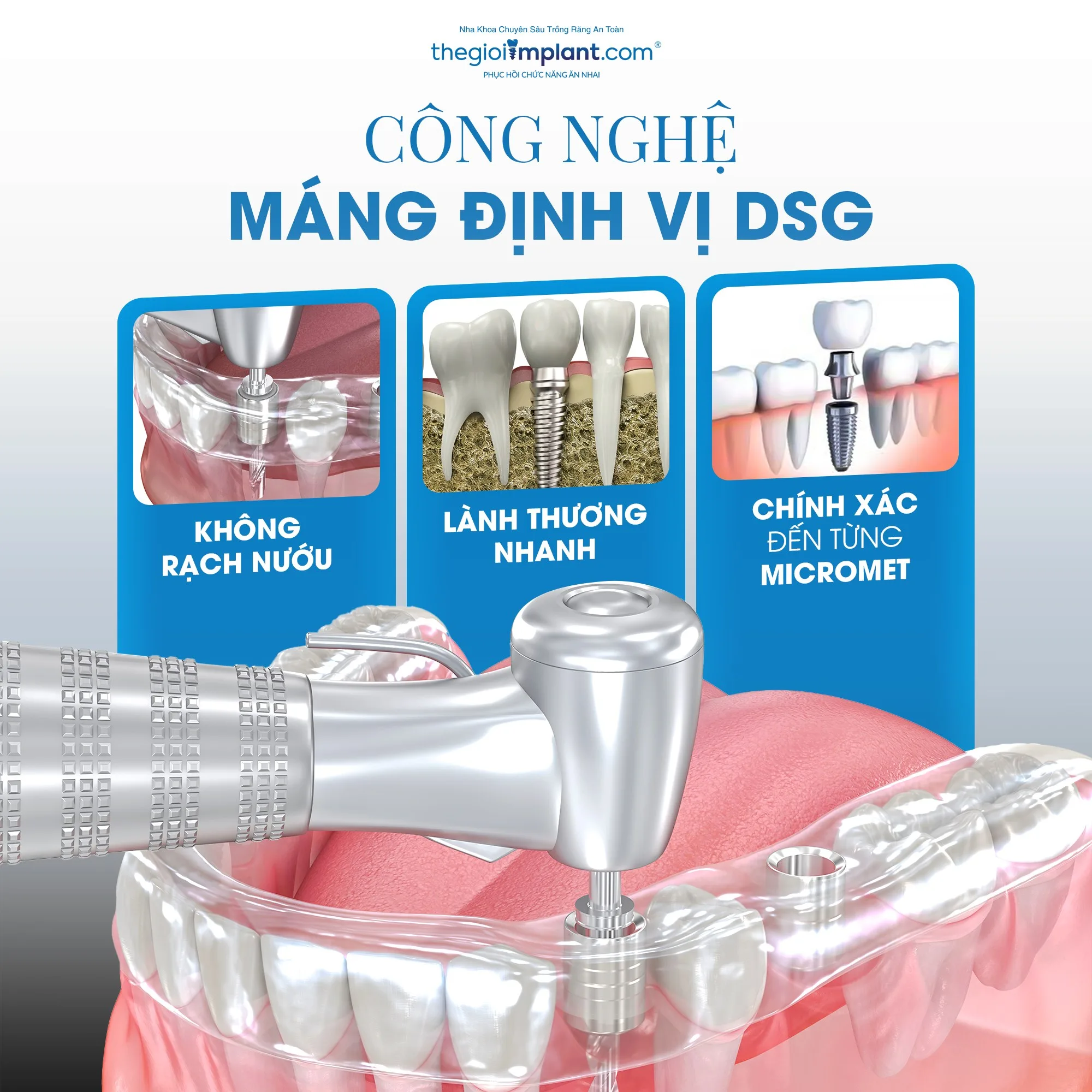 trồng răng implant không đau - hình 2