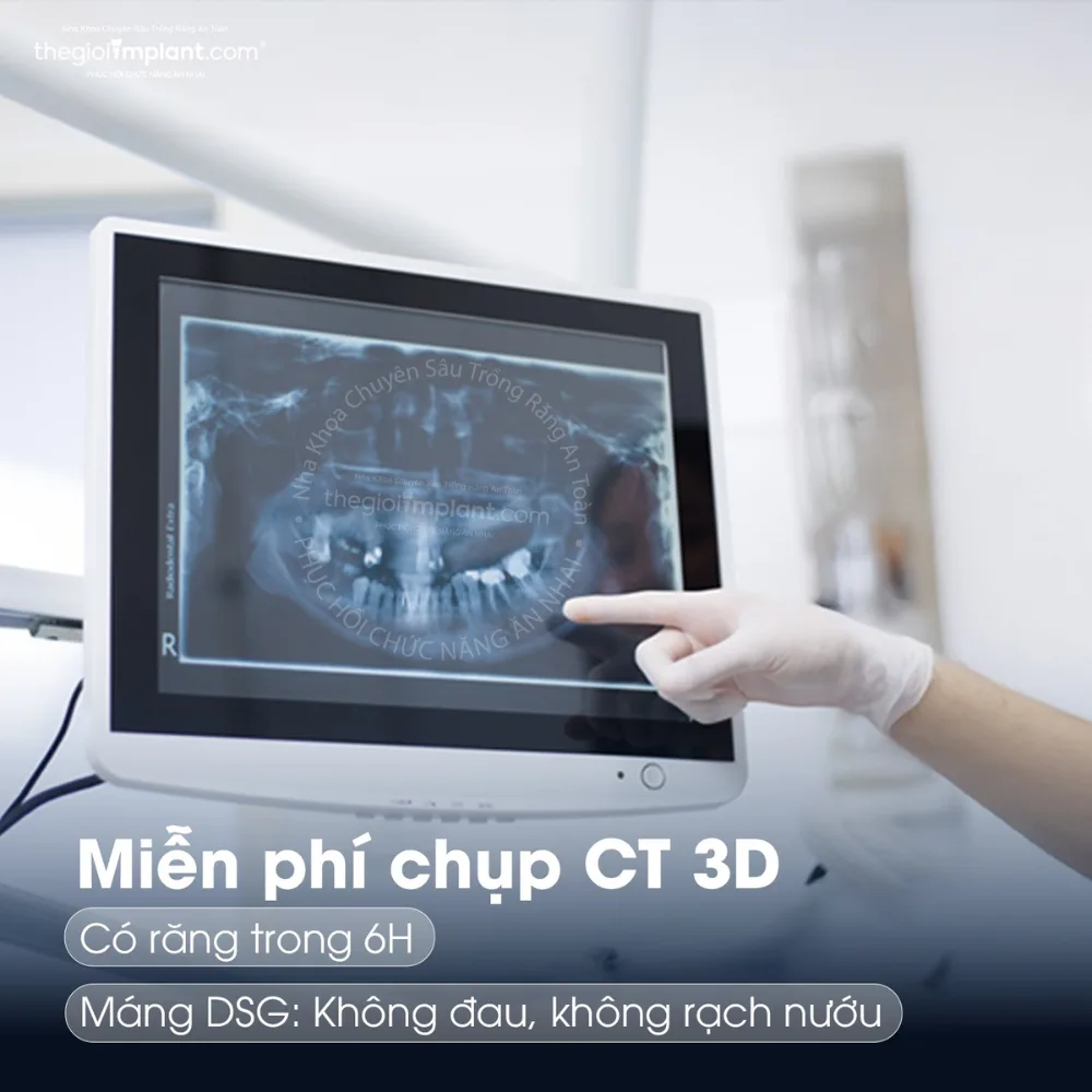 trồng răng implant không đau - hình 4