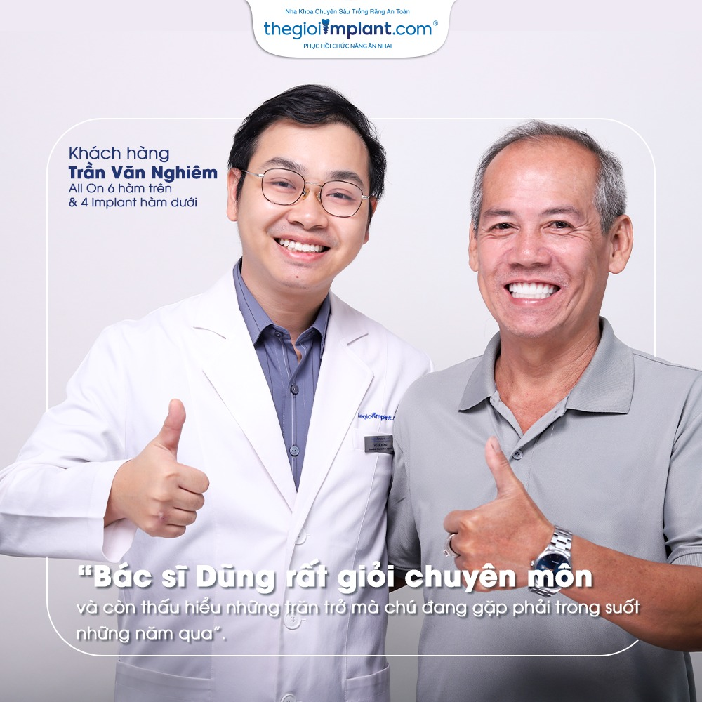 tư vấn implant miễn phí - hình 3