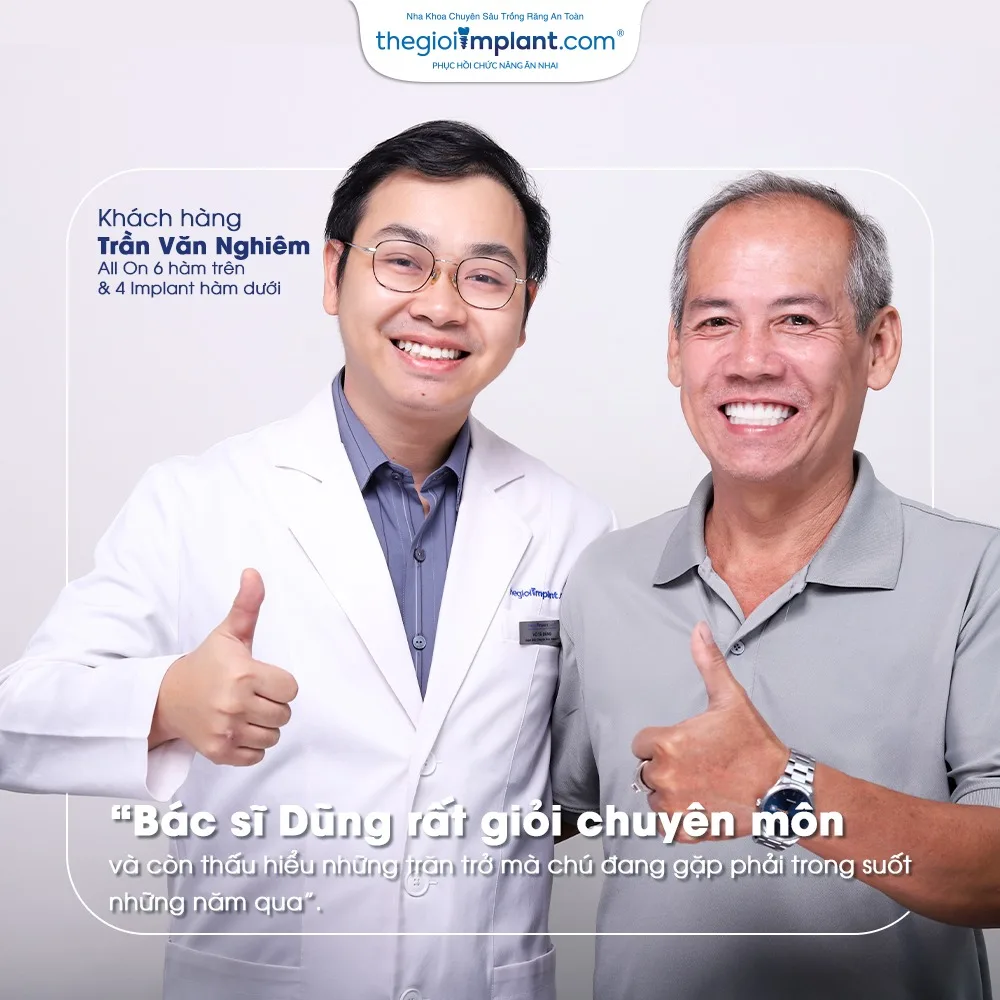 tư vấn implant miễn phí - hình 3