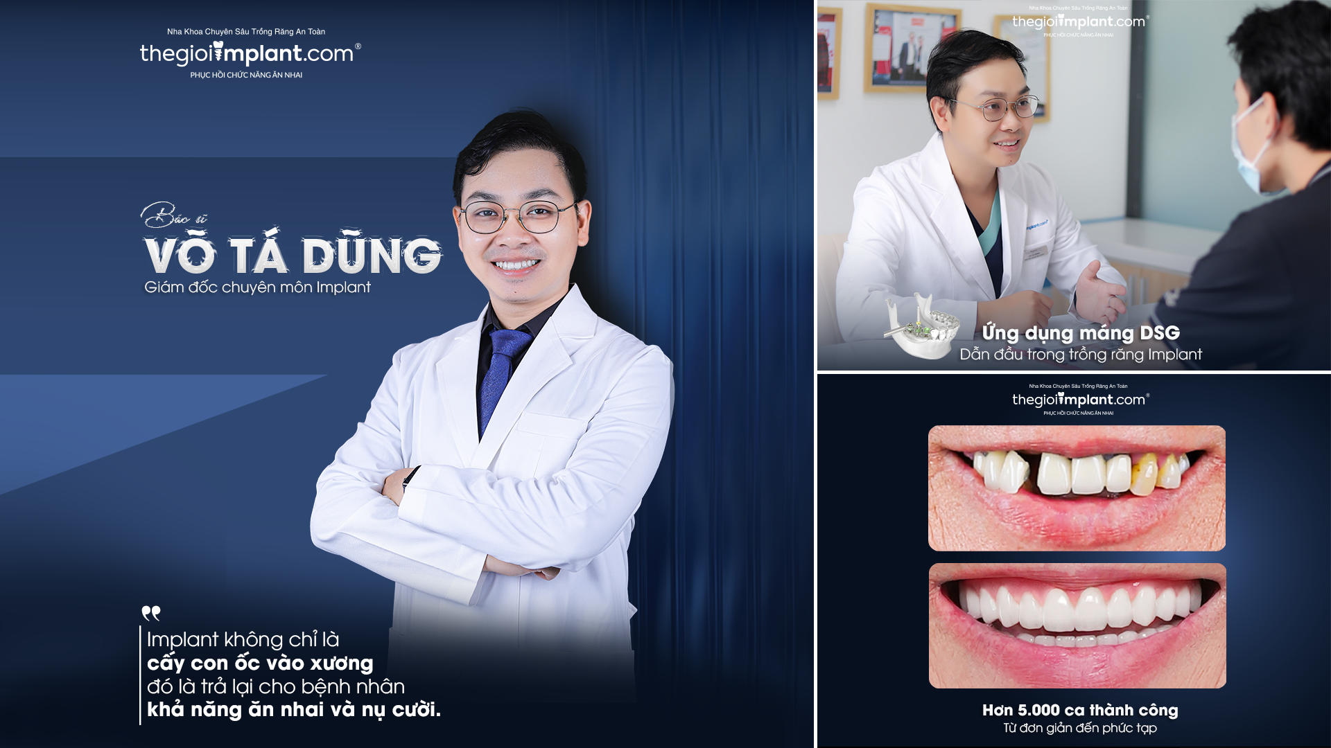 Trồng răng Implant Việt Kiều: quy trình 2026