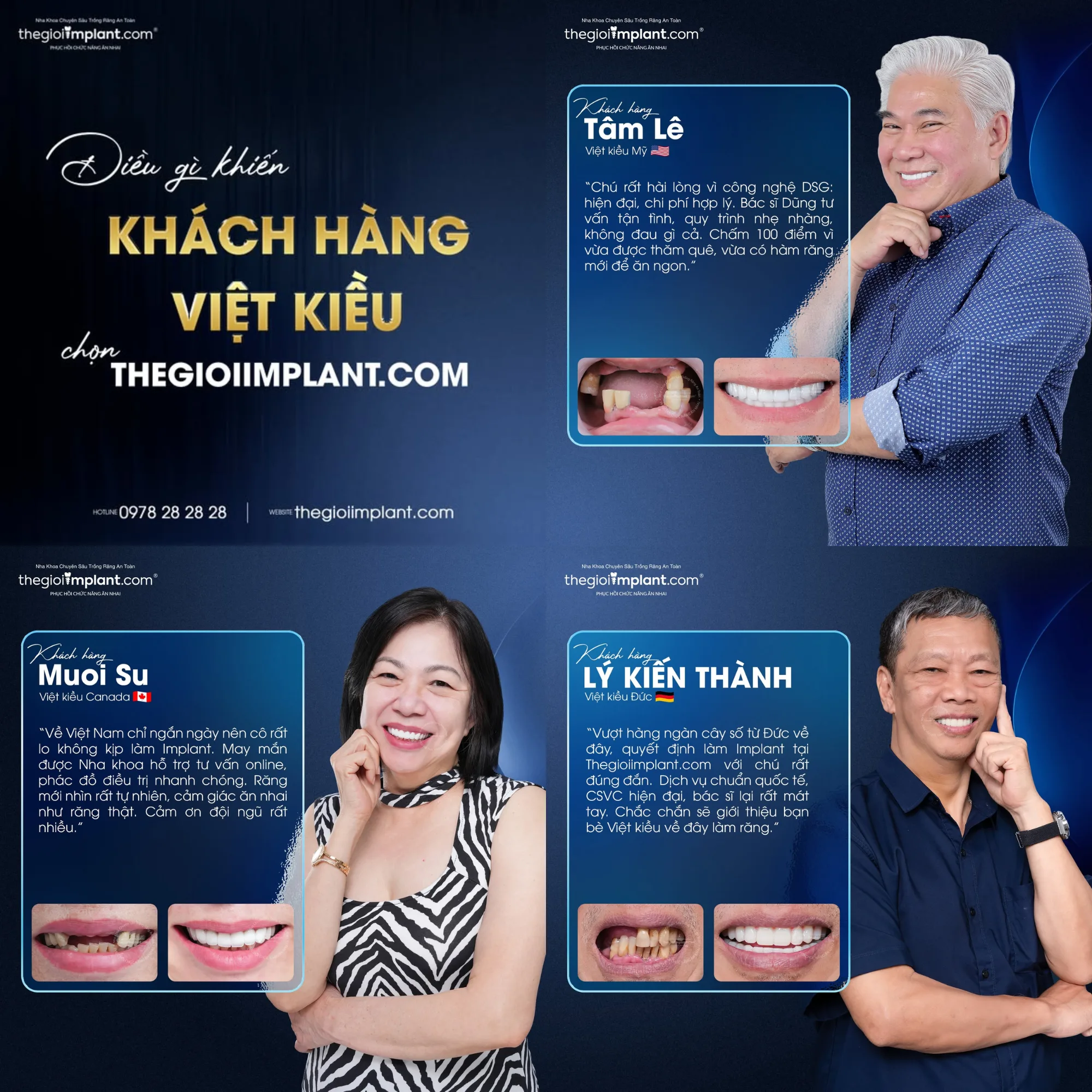 Trồng răng Implant Việt Kiều: quy trình 2026