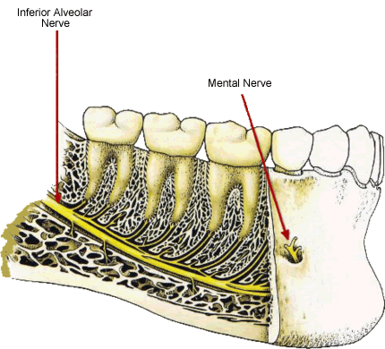 cấy implant hàm dưới - hình 3