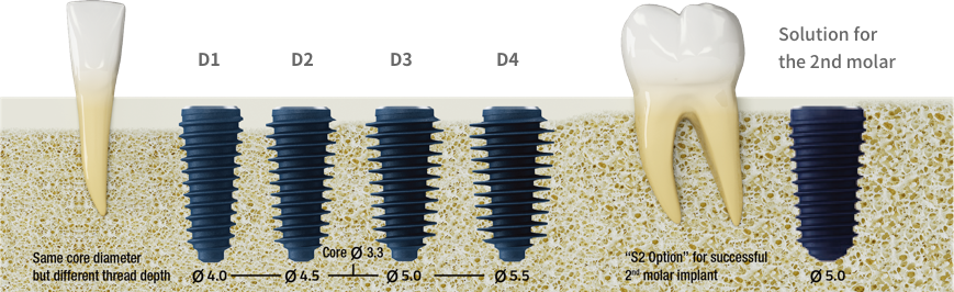 implant megagen anyridge - hình 3