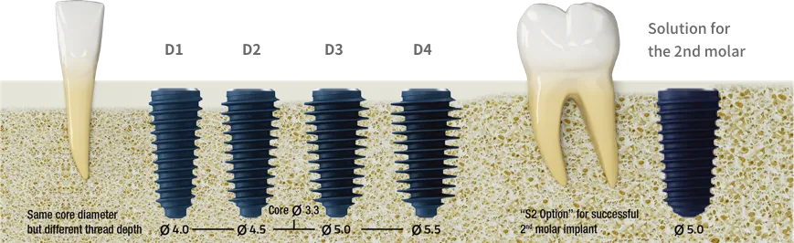 implant megagen anyridge - hình 3