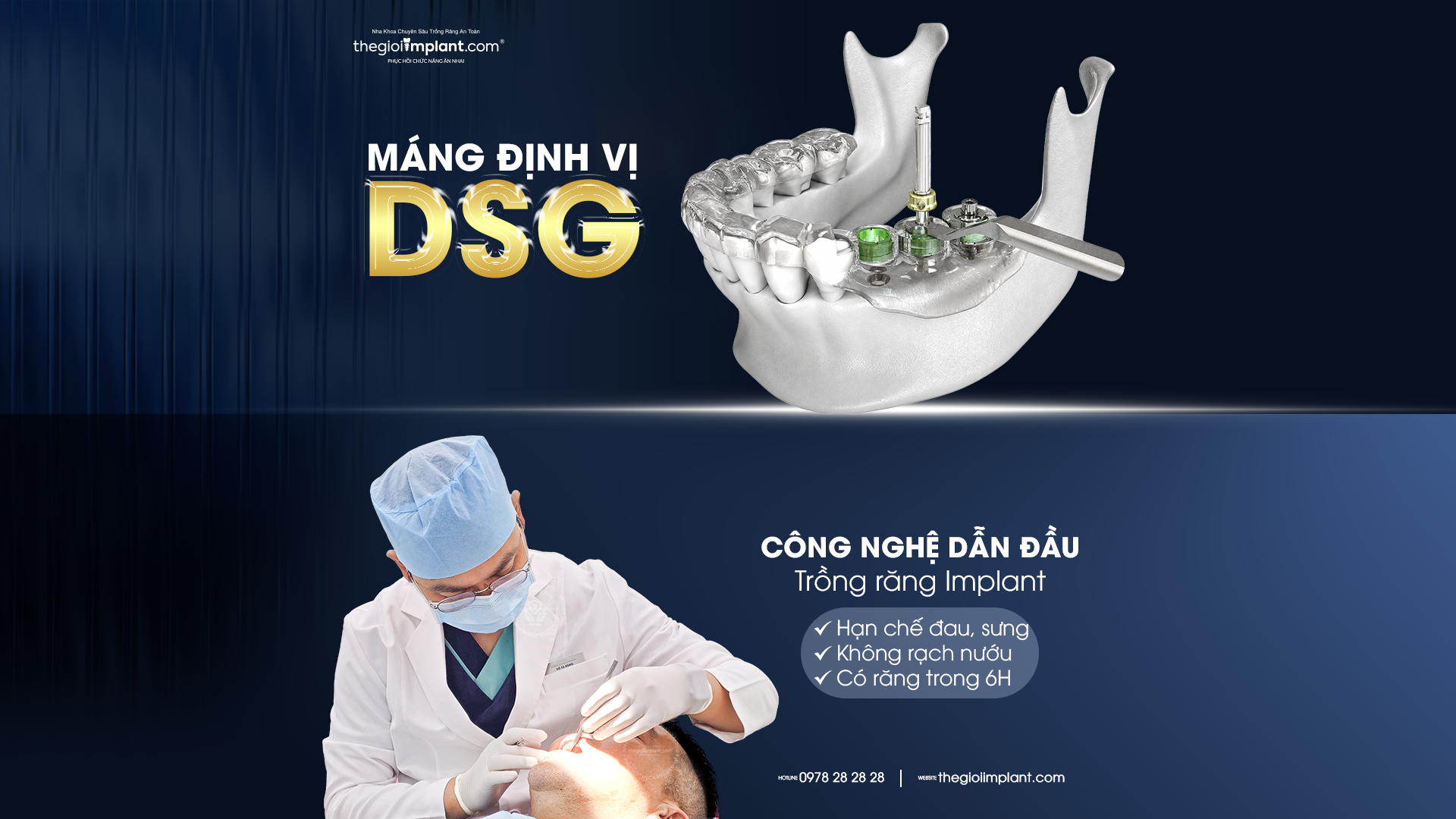 implant osstem ts3 - hình 5
