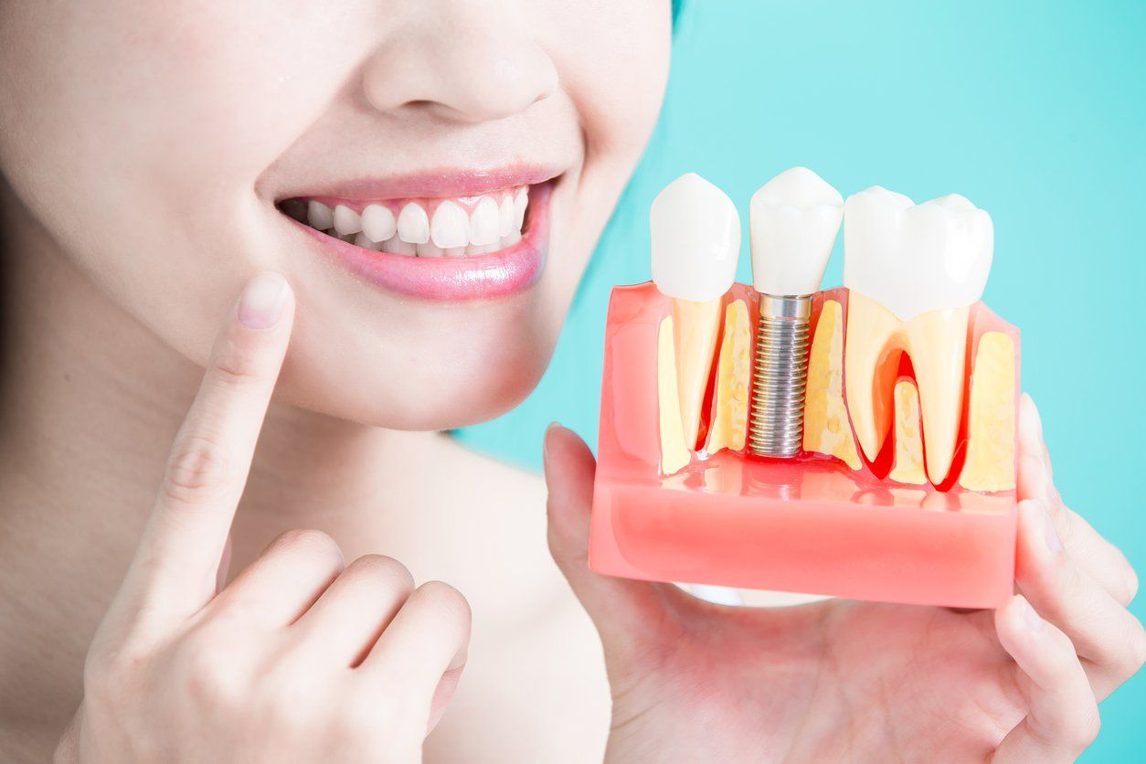 Lành thương 2 tuần đầu sau cấy Implant 2026
