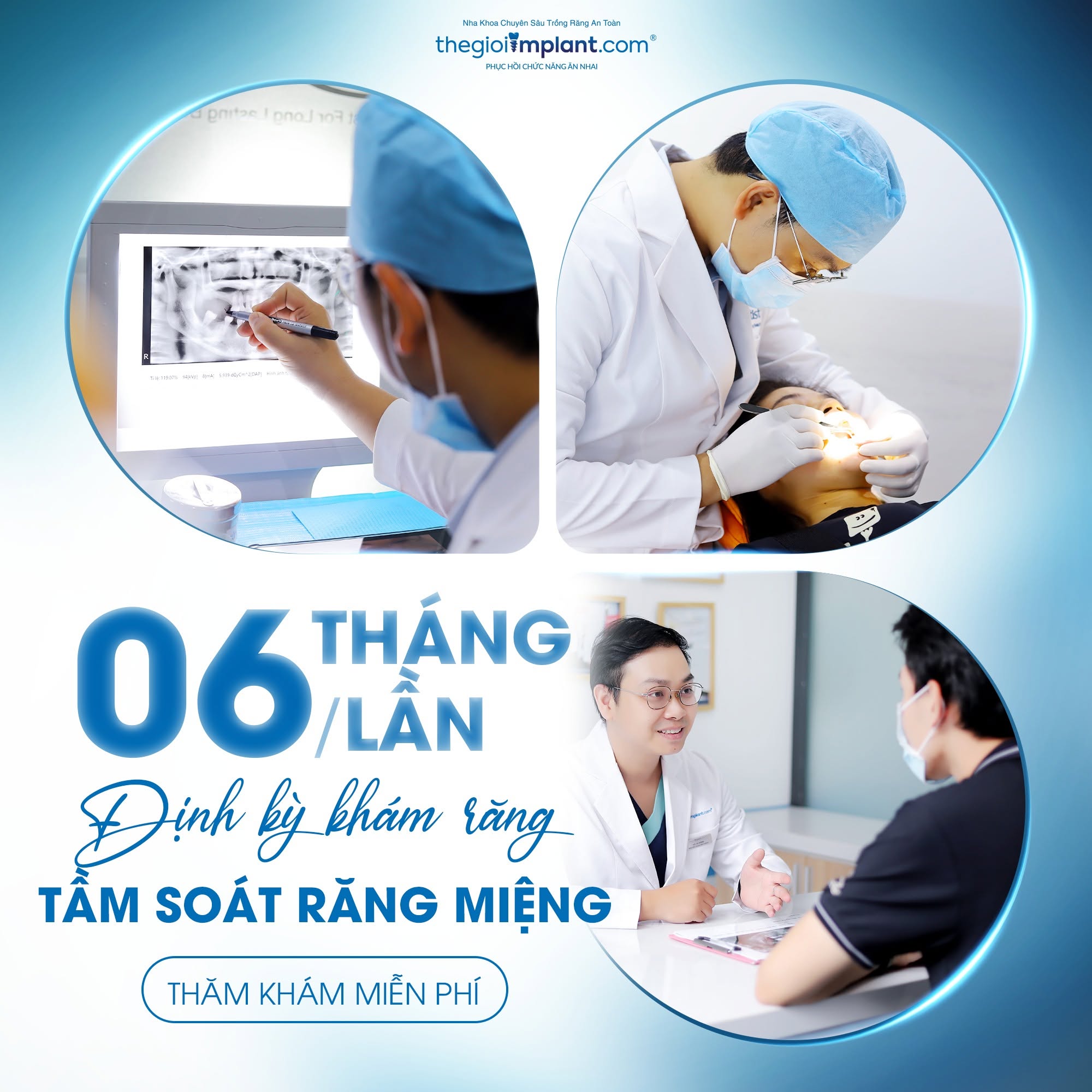 vệ sinh implant trọn đời - hình 3