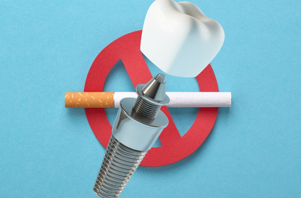 ăn gì tăng tốc implant - hình 4