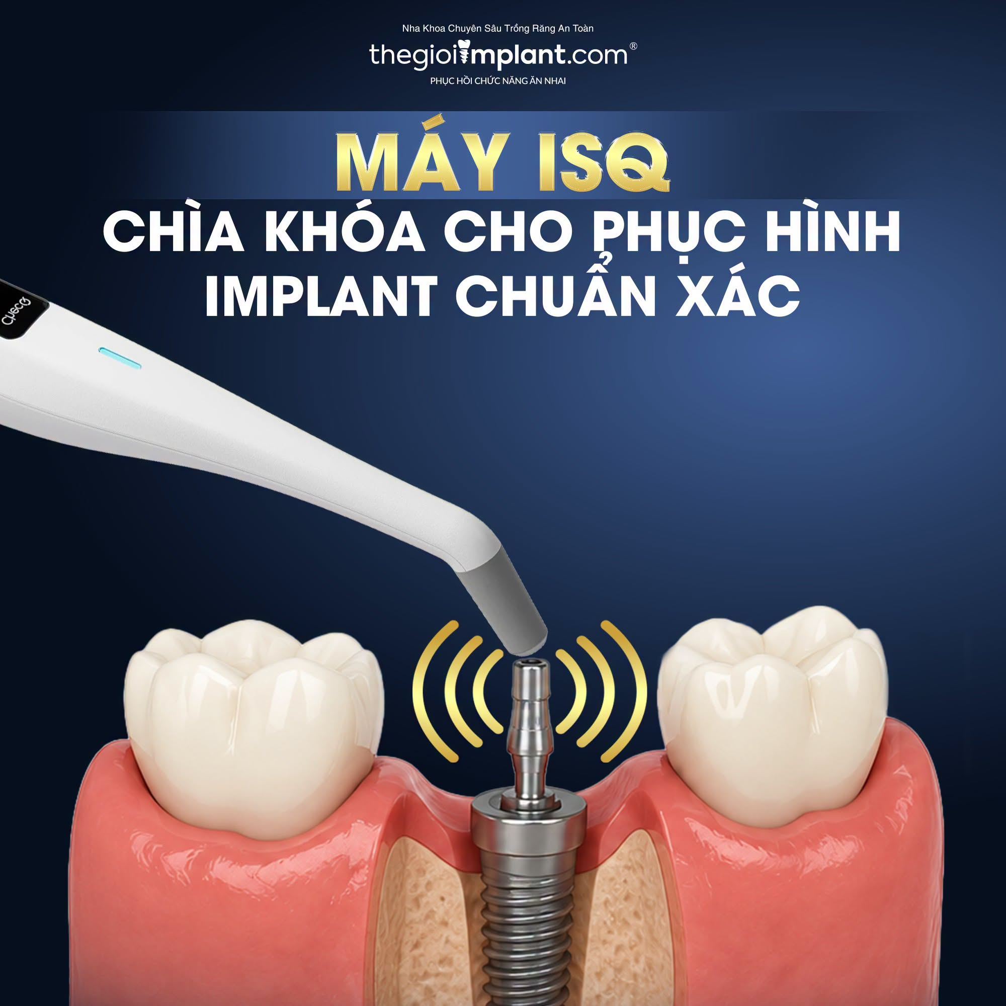 bao lâu tích hợp xương - hình 4