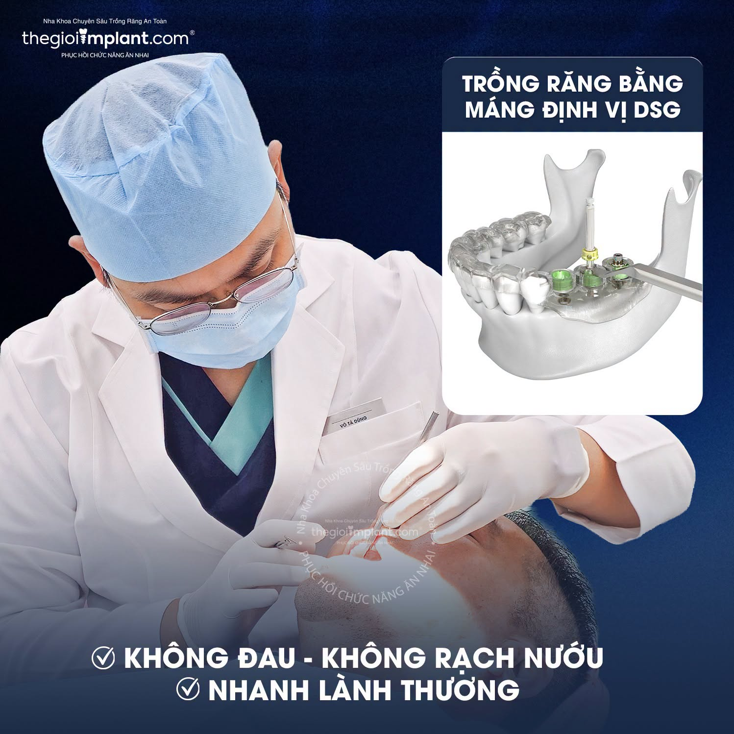chi phí implant toàn hàm - hình 4