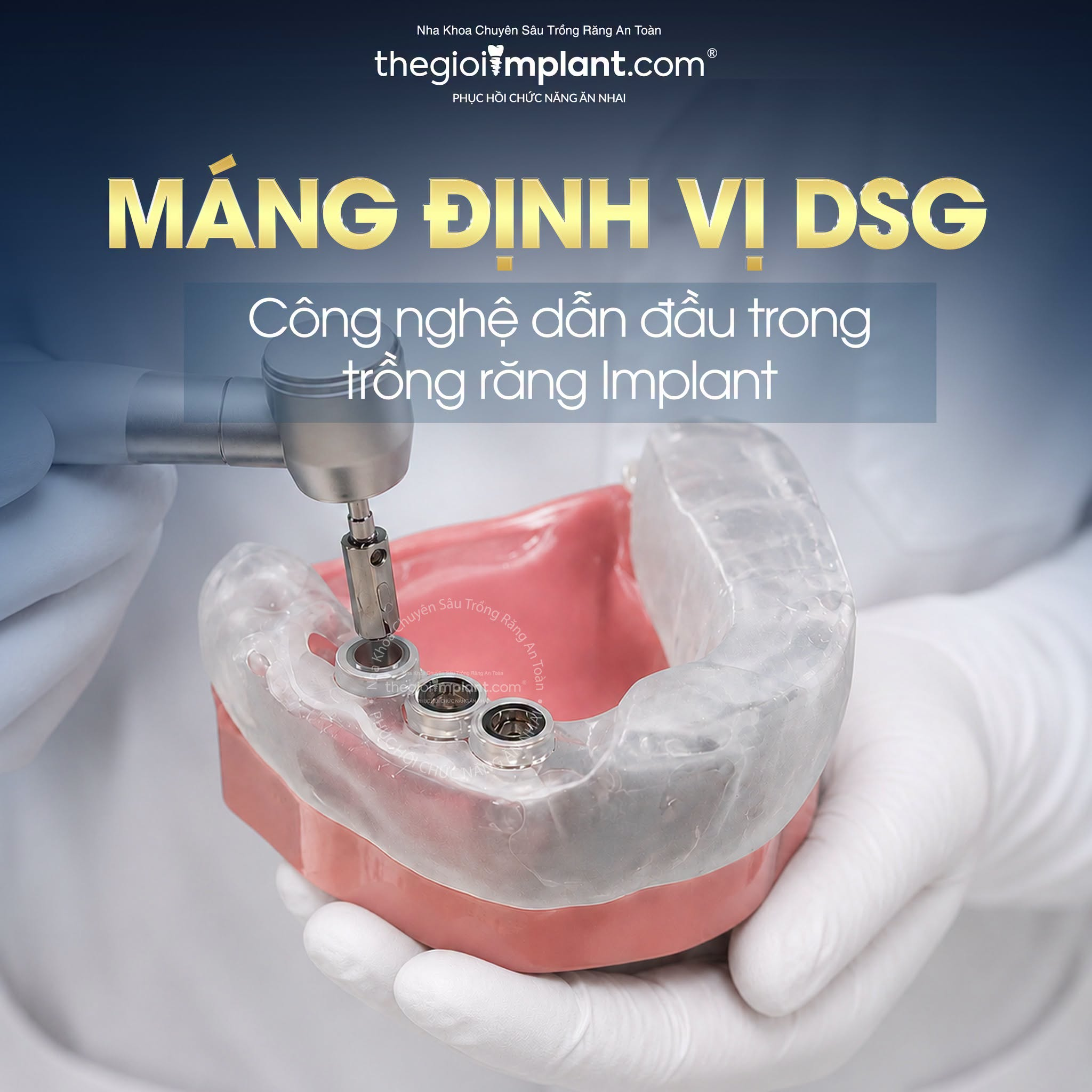 hàm tháo lắp trên implant - hình 4