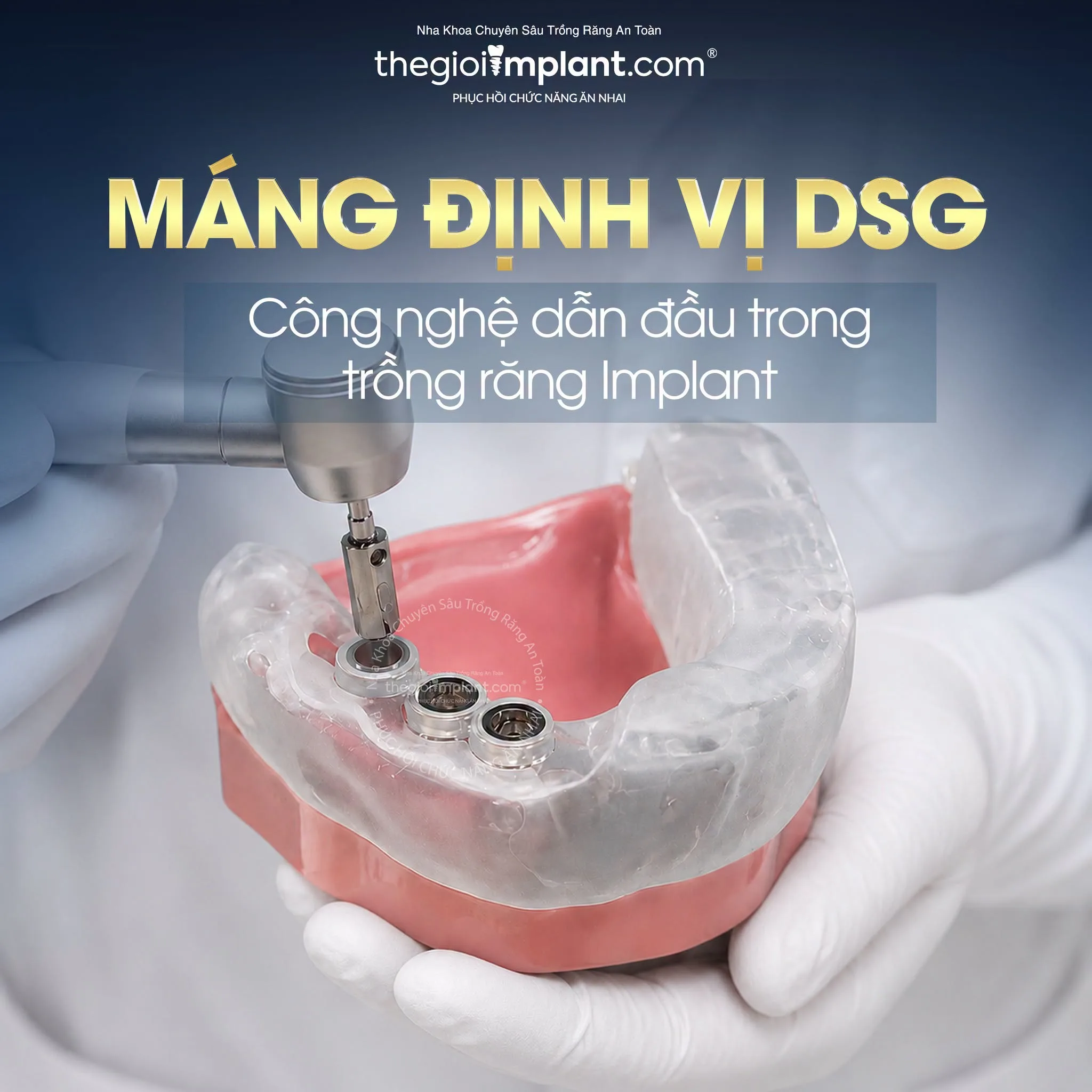 hàm tháo lắp trên implant - hình 4