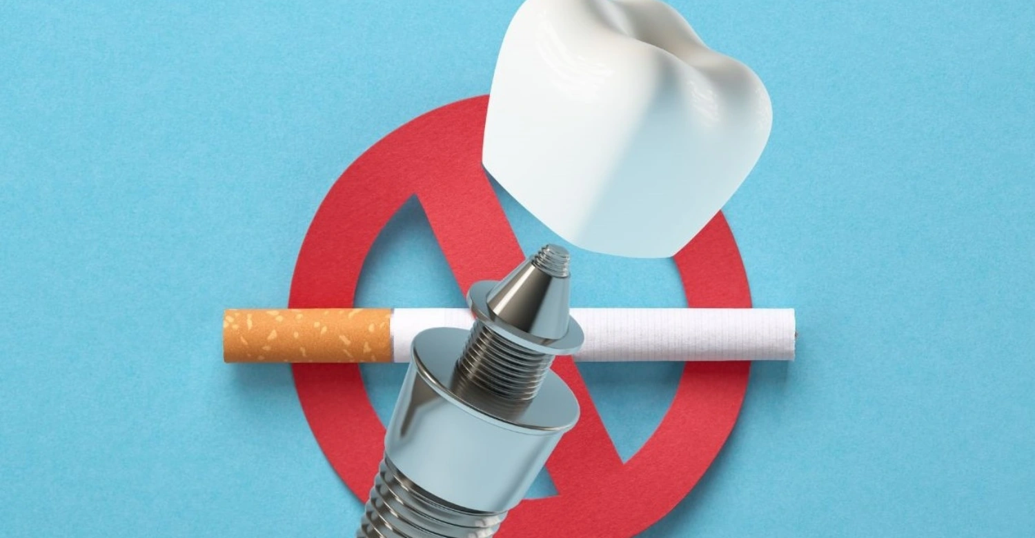 hút thuốc sau implant - hình 2