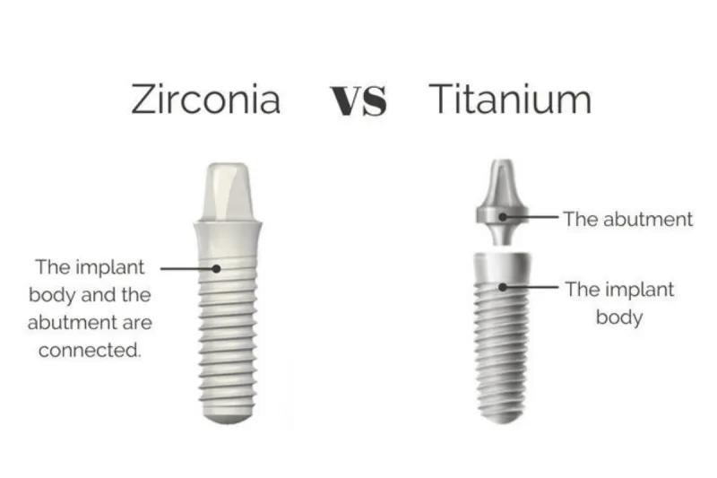 implant có gây dị ứng - hình 4