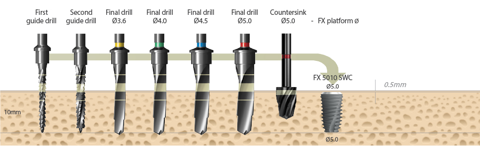 implant dentium nr - hình 2