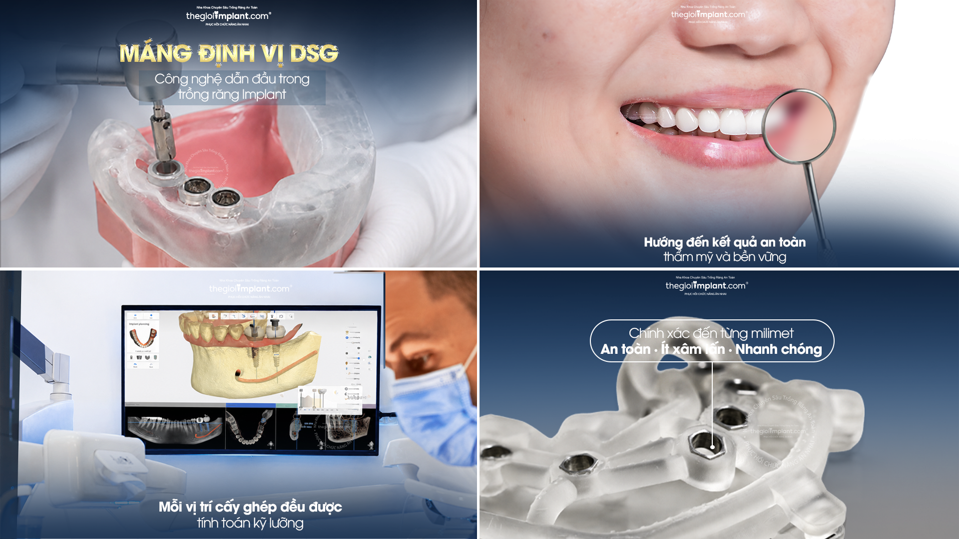 implant răng cửa thẩm mỹ - hình 4