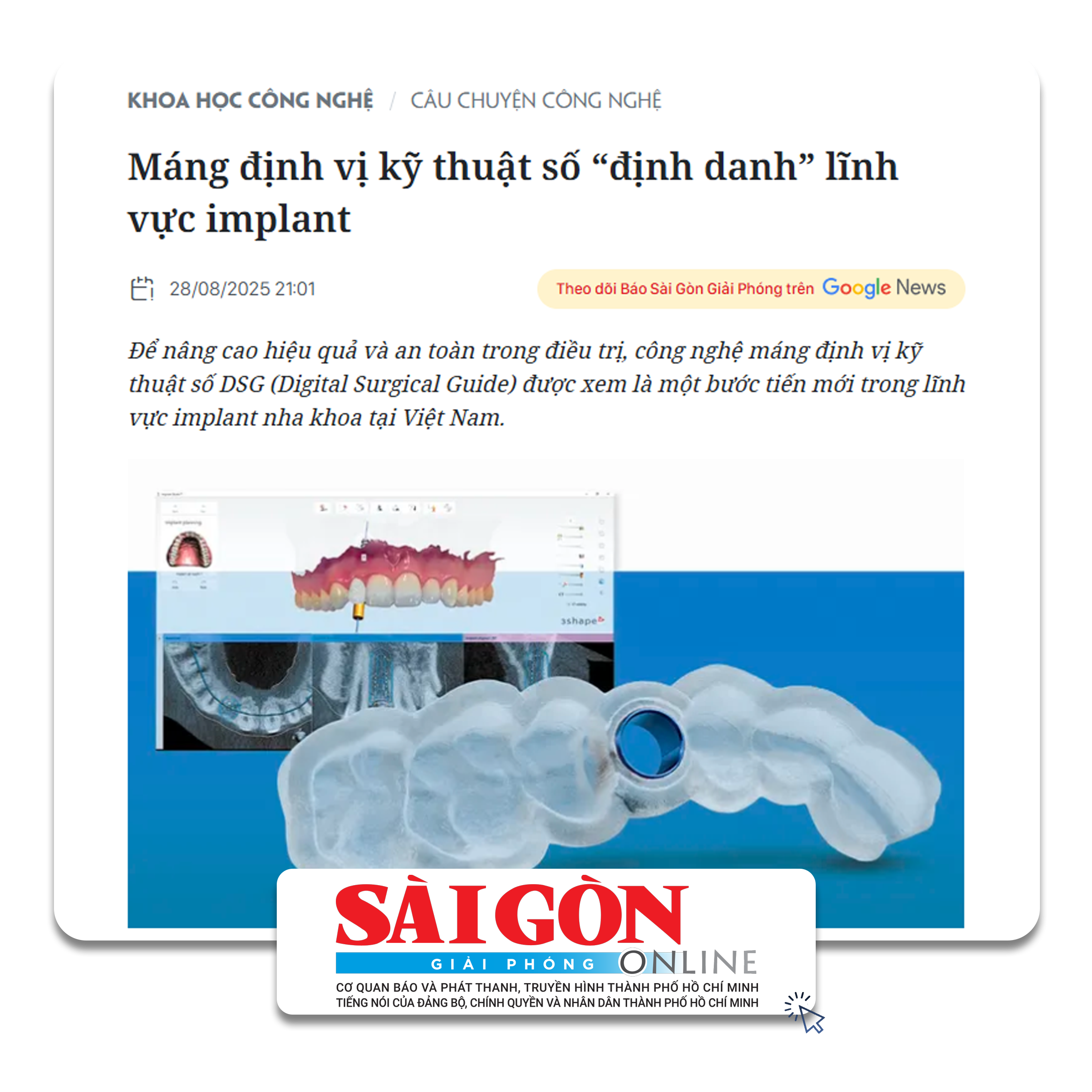 Báo Sài Gòn Giải Phóng viết về San Dentist