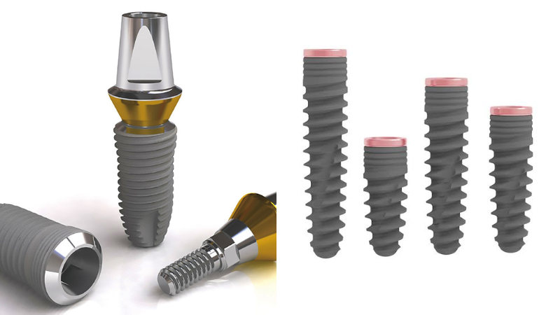 Top 5 hãng Implant Hàn Quốc vs Ý/Đức/Thụy Sĩ 2026