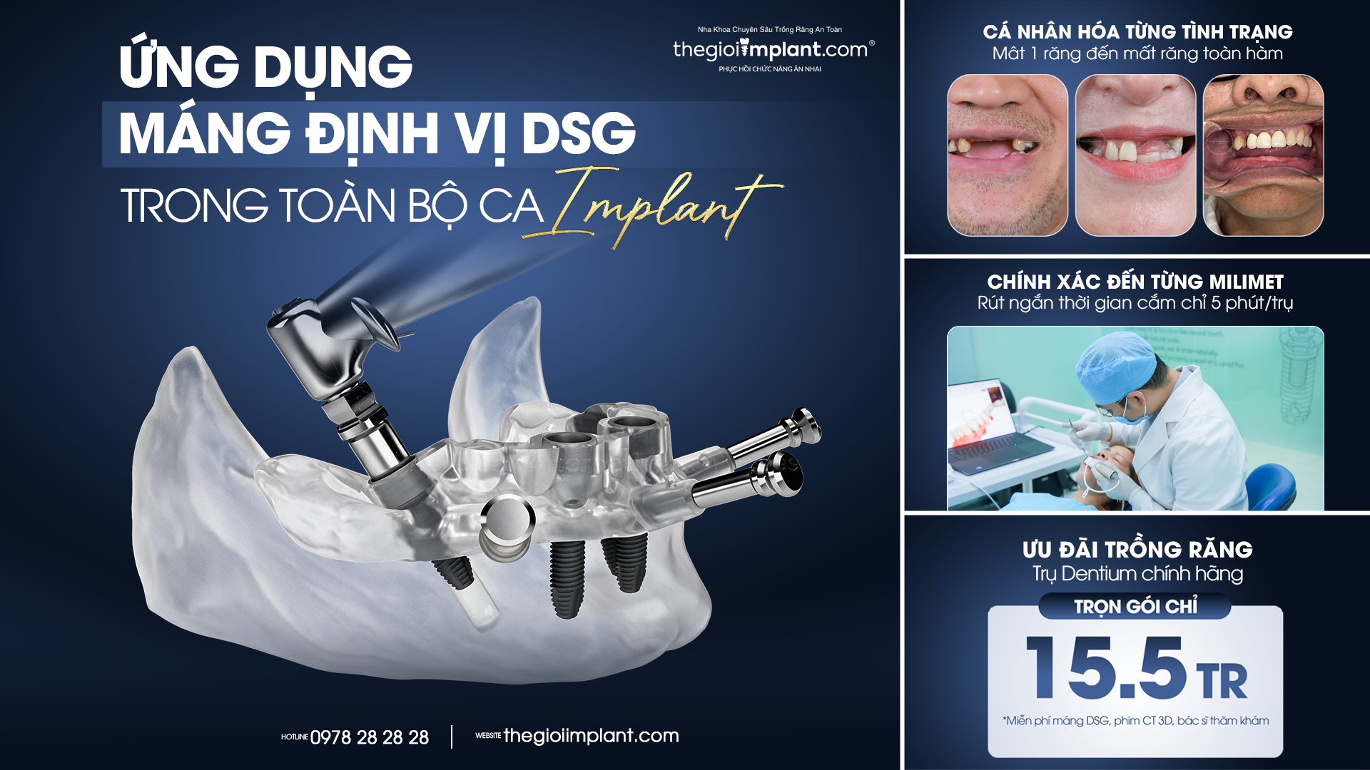 implant btk - hình 4